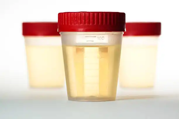 Low Urine Output